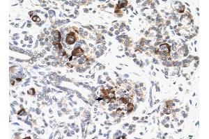 MAP2K2 antibody was used for immunohistochemistry at a concentration of 4-8 ug/ml to stain Epithelial cells of pancreatic acinus (arrows) in Human Pancreas. (MEK2 antibody  (C-Term))