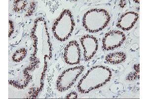 Image no. 1 for anti-Golgi Membrane Protein 1 (GOLM1) antibody (ABIN1498496) (GOLM1 antibody)