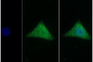 Detection of CLU in Human Hela cell using Polyclonal Antibody to Clusterin (CLU) (Clusterin antibody  (AA 229-446))