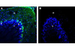 Expression of BMPR1A in mouse cerebellum.