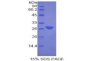 SDS-PAGE (SDS) image for Surfactant Protein B (SFTPB) (AA 111-352) protein (His tag) (ABIN2122154) (SFTPB Protein (AA 111-352) (His tag))