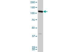 FLJ20097 monoclonal antibody (M01), clone 2D11 Western Blot analysis of FLJ20097 expression in HeLa . (Syndetin/VPS50 antibody  (AA 862-964))