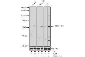 Western blot analysis of extracts of various cell lines, using Phospho--T308 antibody (ABIN3020075, ABIN3020076, ABIN3020077 and ABIN6225508) at 1:500 dilution. (AKT1 antibody  (pThr308))