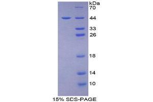 SDS-PAGE (SDS) image for CD2-Associated Protein (Cd2ap) (AA 149-429) protein (His tag) (ABIN2124276)