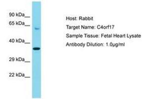 Image no. 1 for anti-Chromosome 4 Open Reading Frame 17 (C4ORF17) (AA 136-185) antibody (ABIN6750545) (C4ORF17 antibody  (AA 136-185))