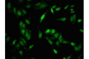 Immunofluorescent analysis of Hela cells using ABIN7160017 at dilution of 1:100 and Alexa Fluor 488-congugated AffiniPure Goat Anti-Rabbit IgG(H+L) (MAP3K11 antibody  (AA 536-693))