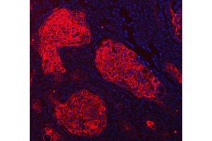 IF analysis of Cytokeratin 1/KRT1 using anti-Cytokeratin 1/KRT1 antibody (ABIN7600651).