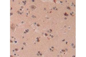 Immunohistochemistry (IHC) image for anti-Fragile X Mental Retardation 1 (FMR1) (AA 1-314) antibody (ABIN1868009)