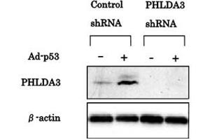 Western blotting was performed using PHLDA3 monoclonal antibody, clone 4B6  to detect PHLDA3 protein expression. (PHLDA3 antibody  (AA 1-31))