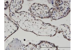 Immunoperoxidase of monoclonal antibody to MYST3 on formalin-fixed paraffin-embedded human placenta.