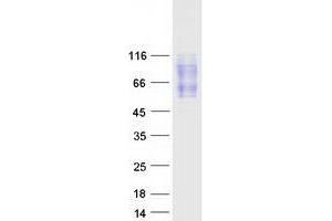Western Blotting (WB) image for CD200 Receptor 1 (CD200R1) (Transcript Variant 4) protein (Myc-DYKDDDDK Tag) (ABIN2713493)
