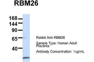 Host:  Rabbit  Target Name:  RBM26  Sample Type:  Human Adult Placenta  Antibody Dilution:  1. (RBM26 antibody  (Middle Region))