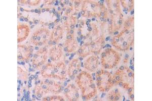 Used in DAB staining on fromalin fixed paraffin- embedded kidney tissue (Ladinin 1 antibody  (AA 1-140))