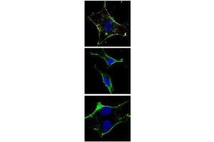 Fluorescent confocal image of SY5Y cells stained with KIT antibody at 1:50. (KIT antibody)