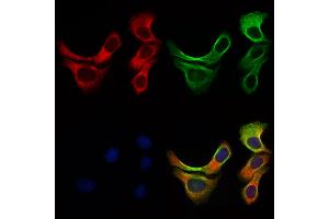 ABIN6257219 and ABIN6276016 staining Hela cells by IF/ICC. (GPR153 antibody  (Internal Region))