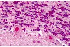 Human Brain, Cerebellum: Formalin-Fixed, Paraffin-Embedded (FFPE) (RBX1 antibody  (C-Term))