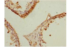 Immunohistochemistry of paraffin-embedded human testis tissue using ABIN7150536 at dilution of 1:100 (DNAJB9 antibody  (AA 24-223))