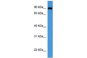 Western Blotting (WB) image for anti-Oxysterol Binding Protein (OSBP) (C-Term) antibody (ABIN2788369) (OSBP antibody  (C-Term))