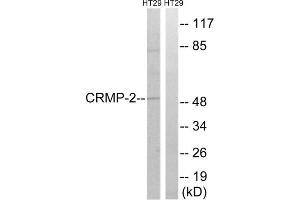 Western blot analysis of extracts from HT-29 cells, treated with heat shock, using CRMP2 (epitope around residue 509) antibody. (DPYSL2 antibody  (Thr509))
