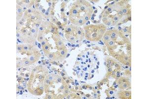 Immunohistochemistry of paraffin-embedded Rat kidney using ITPKB Polyclonal Antibody at dilution of 1:100 (40x lens). (ITPKB antibody)