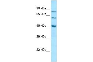 Western Blotting (WB) image for anti-Sulfatase Modifying Factor 1 (SUMF1) (N-Term) antibody (ABIN2789756)