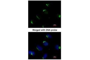ICC/IF Image Immunofluorescence analysis of paraformaldehyde-fixed HeLa, using Bag1, antibody at 1:200 dilution. (BAG1 antibody)