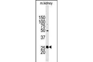 Western blot analysis of anti-STC2 Antibody in mouse kidney tissue lysates (35ug/lane). (Stanniocalcin 2 antibody  (N-Term))
