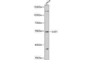 Western blot analysis of extracts of HeLa cells, using L antibody (ABIN7268174) at 1:1000 dilution. (Ladinin 1 antibody  (AA 40-200))