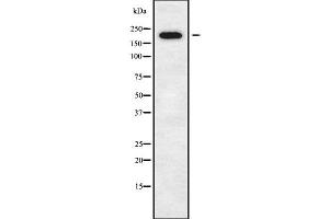 Western blot analysis of DOCK11 using K562 whole cell lysates (DOCK11 antibody  (Internal Region))