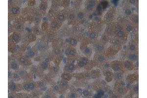 Detection of GSTt2 in Mouse Liver Tissue using Polyclonal Antibody to Glutathione S Transferase Theta 2 (GSTt2) (GSTT2 antibody  (AA 15-216))
