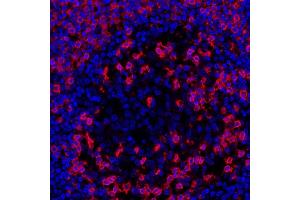 Immunofluorescence (IF) image for anti-CD45RO (CD45RO) antibody (ABIN7449553) (CD45RO antibody)
