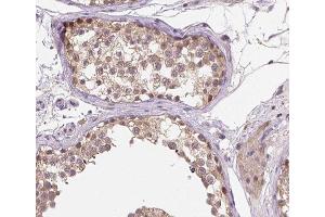 ABIN6266523 at 1/200 staining human testis tissue sections by IHC-P. (Cyclin A1 antibody  (C-Term))