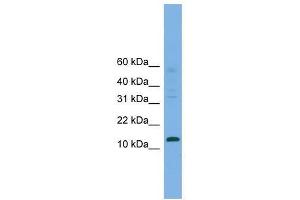 Western Blot showing CRABP2 antibody used at a concentration of 1-2 ug/ml to detect its target protein. (CRABP2 antibody  (Middle Region))