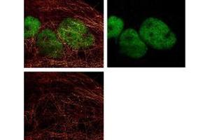 STED Immunofluorescence Microscopy - Dylight 488 conjugated antibody 488 conjugated anti-Rabbit IgG was used to demonstrate 2 color STED immunofluorescence microscopy. (Goat anti-Rabbit IgG Antibody (DyLight 488) - Preadsorbed)