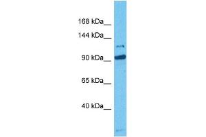 Host:  Rabbit  Target Name:  MORC3  Sample Tissue:  Human HCT116 Whole Cell  Antibody Dilution:  1ug/ml (MORC3 antibody  (C-Term))