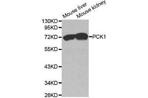 Western blot analysis of extracts of various cell lines, using PCK1 antibody. (PCK1 antibody  (C-Term))