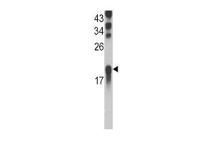 Western blot analysis of UBE2L3 Antibody (N-term) (ABIN388851 and ABIN2839153) in Ramos cell line lysates (35 μg/lane). (UBE2L3 antibody  (N-Term))