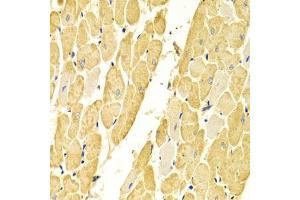 Immunohistochemistry of paraffin-embedded rat heart using CA3 Antibody (ABIN5970554) at dilution of 1/100 (40x lens).