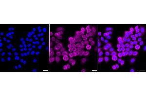 Immunocytochemical staining of HepG2 cells with NF-kB p65 antibody (ABIN7799645), 1:1,000). (Recombinant NF-kB p65 antibody)