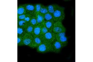 IF analysis of Calpain 1 using anti-Calpain 1 antibody (ABIN7601600). (CAPNL1 antibody  (AA 396-555))