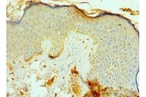 Immunohistochemistry of paraffin-embedded human skin tissue using ABIN7164791 at dilution of 1:100 (FAP antibody  (AA 26-280))