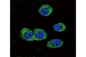 Confocal immunofluorescent analysis of RAGE antibody with MDA-MB231 cells followed by Alexa Fluor 488-conjugated goat anti-rabbit lgG (green). (RAGE antibody  (AA 206-234))