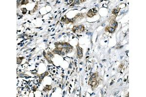 IHC analysis of RICTOR using anti-RICTOR antibody (ABIN7600744).
