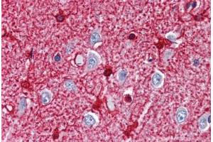 Human Brain, Cortex (formalin-fixed, paraffin-embedded) stained with GLUL antibody ABIN337301 at 10 ug/ml followed by biotinylated anti-mouse IgG secondary antibody ABIN481714, alkaline phosphatase-streptavidin and chromogen. (GLUL antibody)