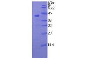 SDS-PAGE analysis of Human TNNT1 Protein.