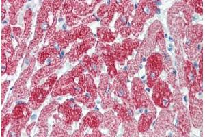 Human Rabbit Heart (formalin-fixed, paraffin-embedded) stained with TNNT2 antibody ABIN462337 followed by biotinylated anti-mouse IgG secondary antibody ABIN481714, alkaline phosphatase-streptavidin and chromogen. (Cardiac Troponin T2 antibody  (Exon 10))