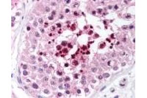 Immunohistochemistry (IHC) image for anti-RAP1 Interacting Factor Homolog (RIF1) (AA 2406-2419) antibody (ABIN2469662) (RIF1 antibody  (AA 2406-2419))