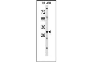 Western blot analysis of HOXB9 / HOX2E Antibody (Center) in HL-60 cell line lysates (35ug/lane).