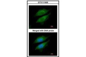 Immunofluorescence analysis of paraformaldehyde-fixed HeLa, using DPRP1 antibody at 1/200 dilution. (DPP8 antibody)