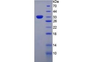 SDS-PAGE of Protein Standard from the Kit  (Highly purified E. (COL7 ELISA Kit)
